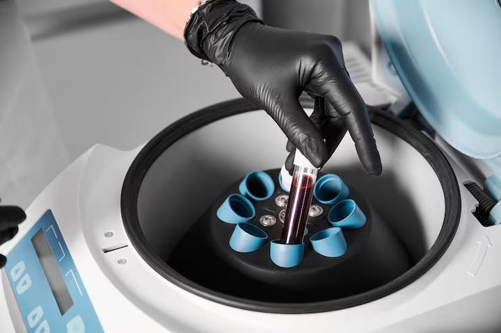 Centrifuges: Tips for Understanding Centrifuge Components