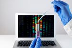 Understanding the Mabtech IL 6 ELISA Kit and How It Works