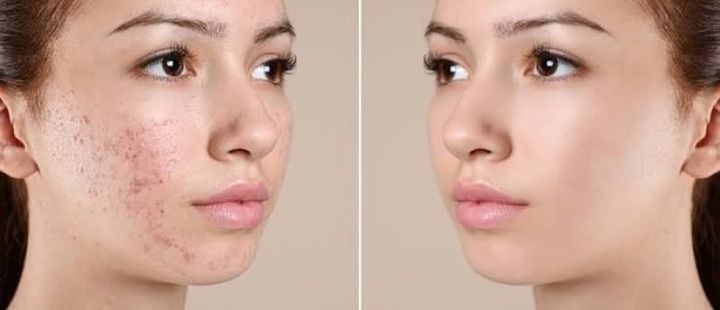 A Guide to Women’s Scar Treatment and Skin Care