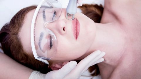 Practical Guide to Skin Resurfacing: Steps, Techniques, and Help