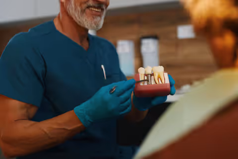 Dental Implant Guide: Types, Procedure & Expert Tips